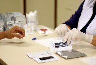 Por que jovens de 20 a 34 anos representam mais de metade dos casos de HIV
