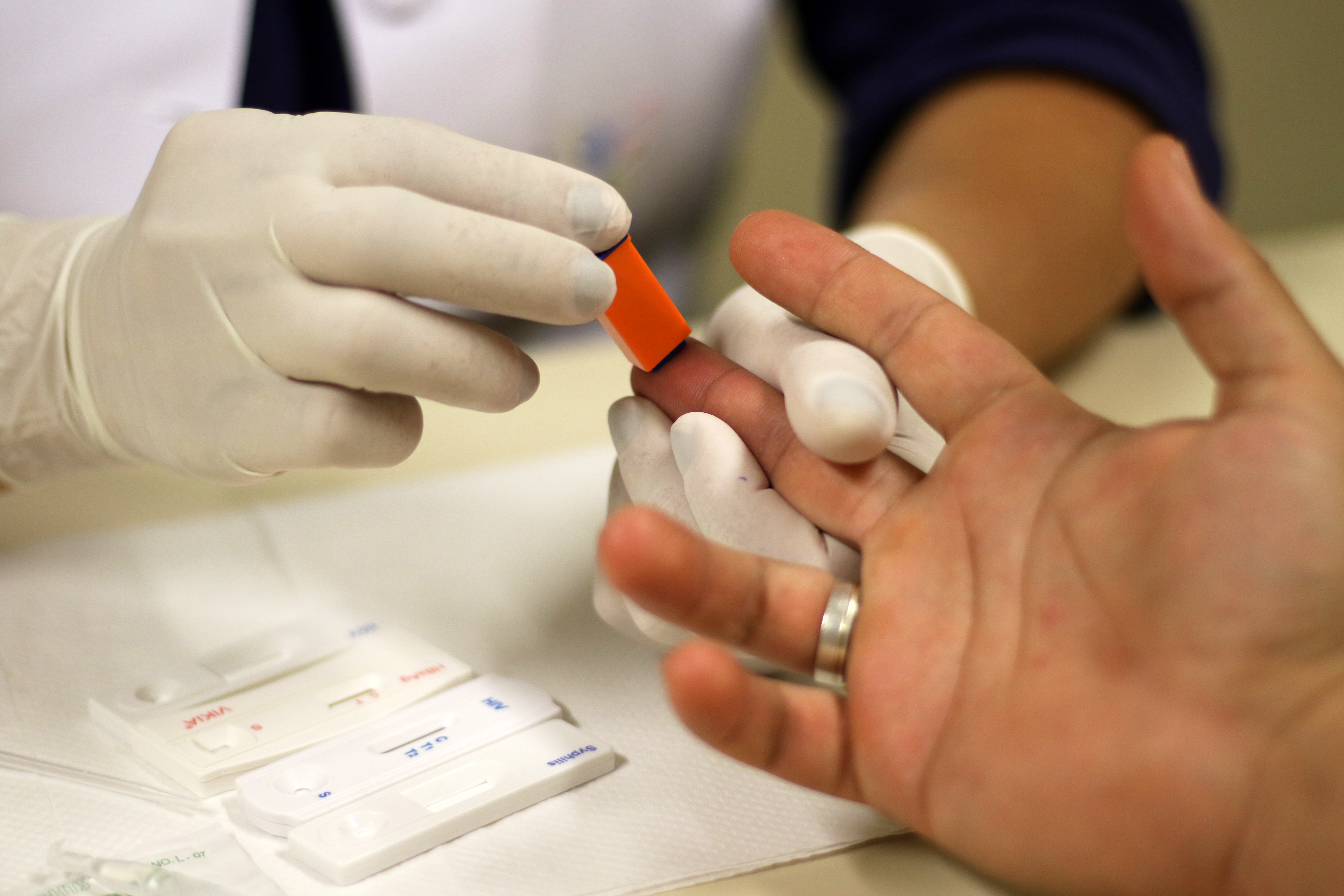 HIV | teste | exame | diagnóstico