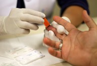 PrEP e PEP: como funciona a prevenção combinada no combate ao HIV
