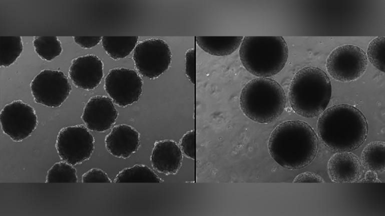 Os organoides do cérebro neandertalizado (à esquerda) são muito diferentes dos organoides do cérebro humano moderno (à direita) / Muotri Lab/UC San Diego