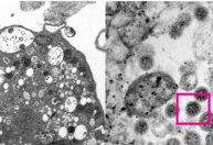 Cientistas revelam primeira imagem da variante Ômicron em microscópio
