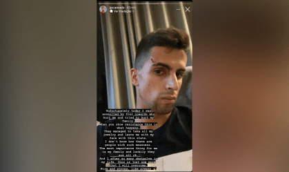 João Cancelo: zagueiro do Manchester City é agredido durante assalto em sua casa