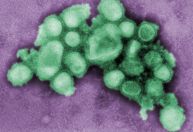 Influenza e Covid-19: especialista explica diferenças e semelhanças