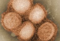 17 estados e o Distrito Federal registraram casos de H3N2