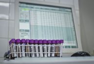 Apagão de dados do Ministério da Saúde deixa monitoramento da pandemia à deriva