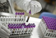 Pesquisa cria método para prever falhas de órgãos do corpo