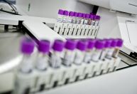 Dia do Hemofílico: como vivem as pessoas que não conseguem coagular o sangue