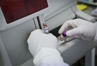 Cientistas avançam no desenvolvimento de diagnóstico de câncer de próstata por exame de sangue