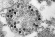 Especialistas dizem que estudo não comprova proteção da Coronavac contra Ômicron