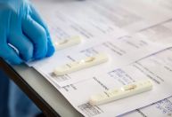 Taxa de positividade de Covid-19 é a maior em 4 meses, diz Abrafarma