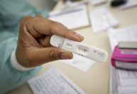Brasil tem aumento de casos de coinfecção por Covid e influenza, diz laboratório