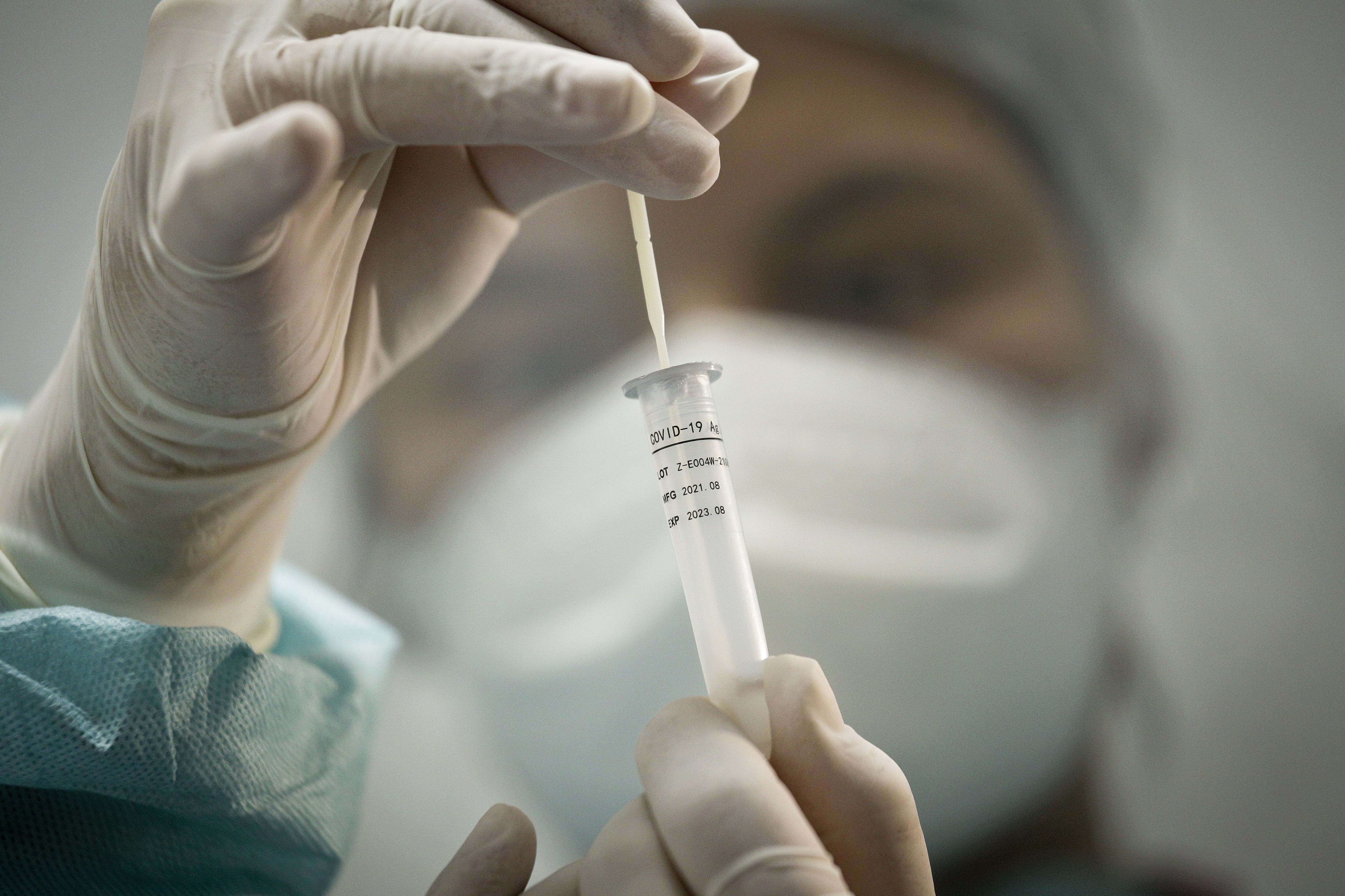 Teste rápido swab nasal para detecção de Covid-19 | coronavírus | testagem | exame | diagnóstico | pandemia | coronavírus | saúde