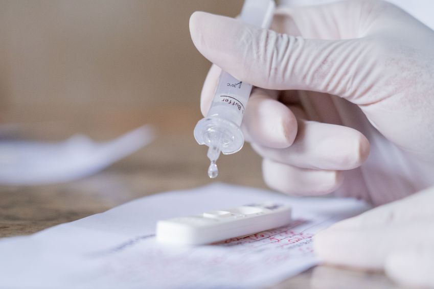 Avanço da variante Ômicron ocasionou escassez nos testes para Covid-19 / Myke Sena/MS