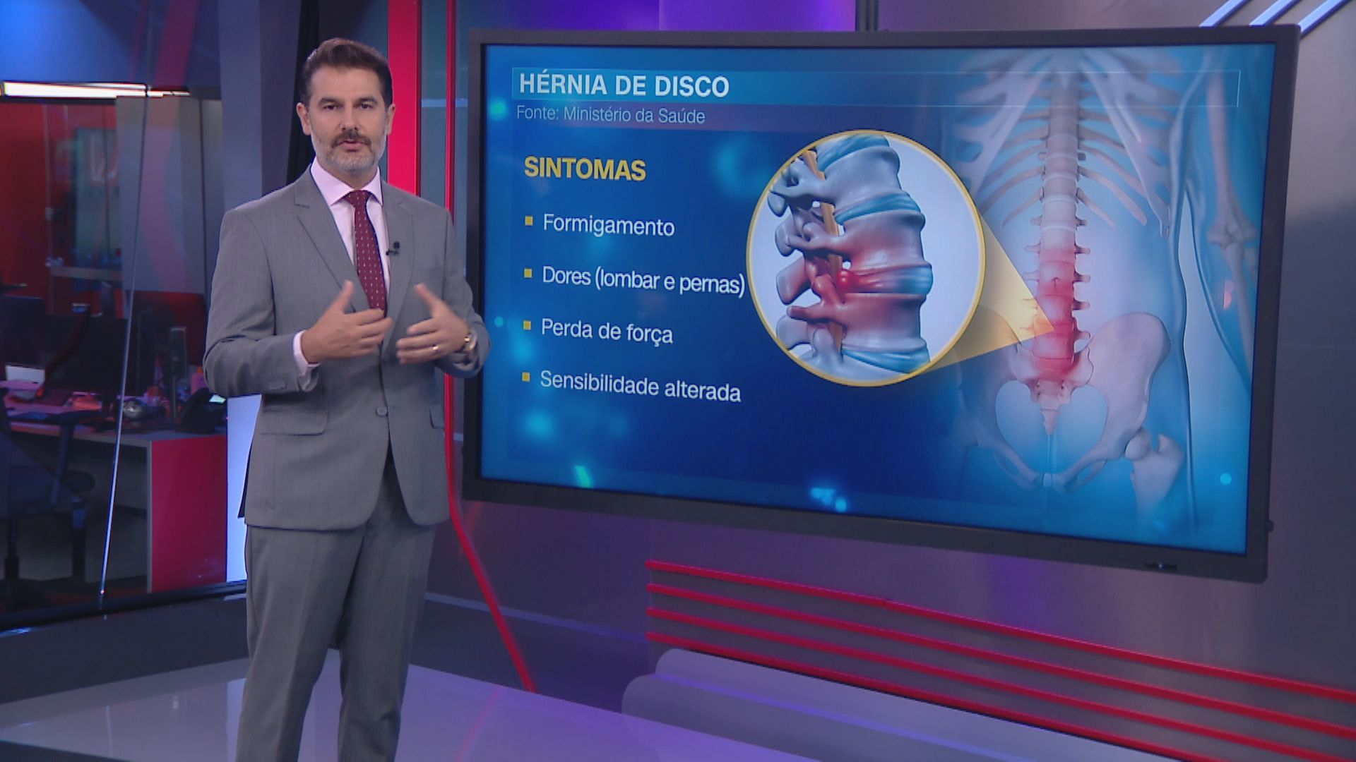 Hérnia de Disco