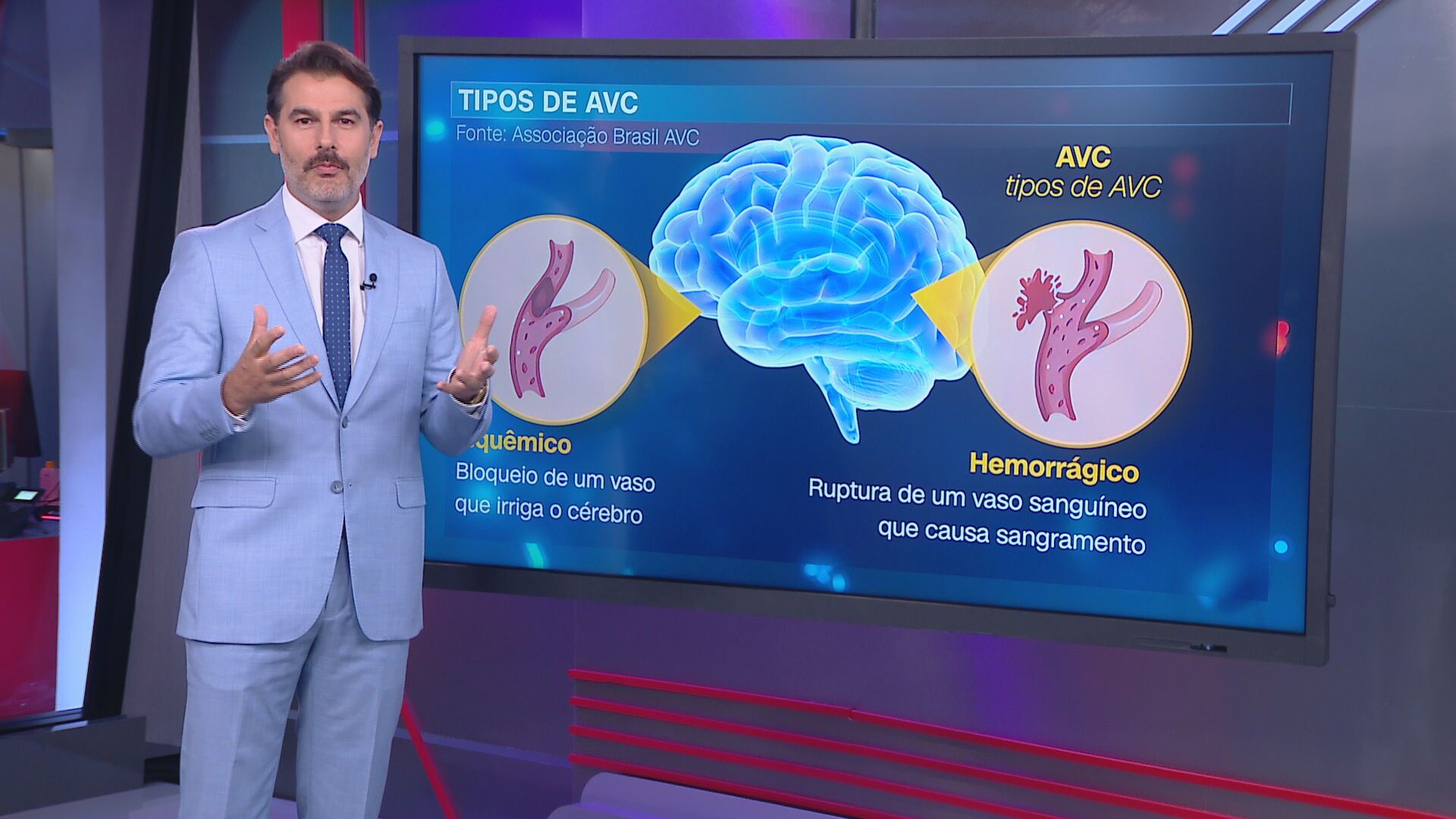 AVC