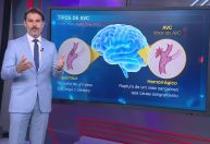 Atendimento rápido em casos de AVC pode ajudar na reversão de quadro clínico