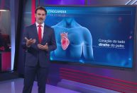 Mulher com coração do lado direito do peito faz cirurgia inédita no Brasil