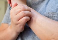 Pesquisadores utilizam ácaro doméstico em terapia contra dermatite atópica
