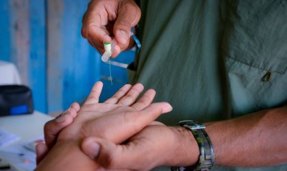 Ministério da Saúde distribuirá 150 mil testes rápidos de hanseníase