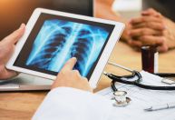 Estudo revela mecanismo que agrava tuberculose e reduz sobrevida
