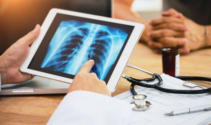Câncer de pulmão: terapia-alvo reduz em 84% risco de morte; veja