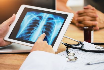 Câncer de pulmão: terapia-alvo reduz em 84% risco de morte; veja