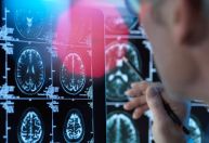 Desequilíbrio da flora intestinal pode levar à doença de Parkinson, diz estudo