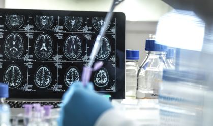 Anvisa aprova 1º tratamento que promete retardar Alzheimer