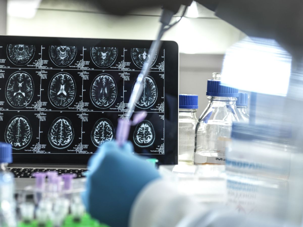 Como manter o cérebro saudável ao envelhecer? Estudo traz respostas