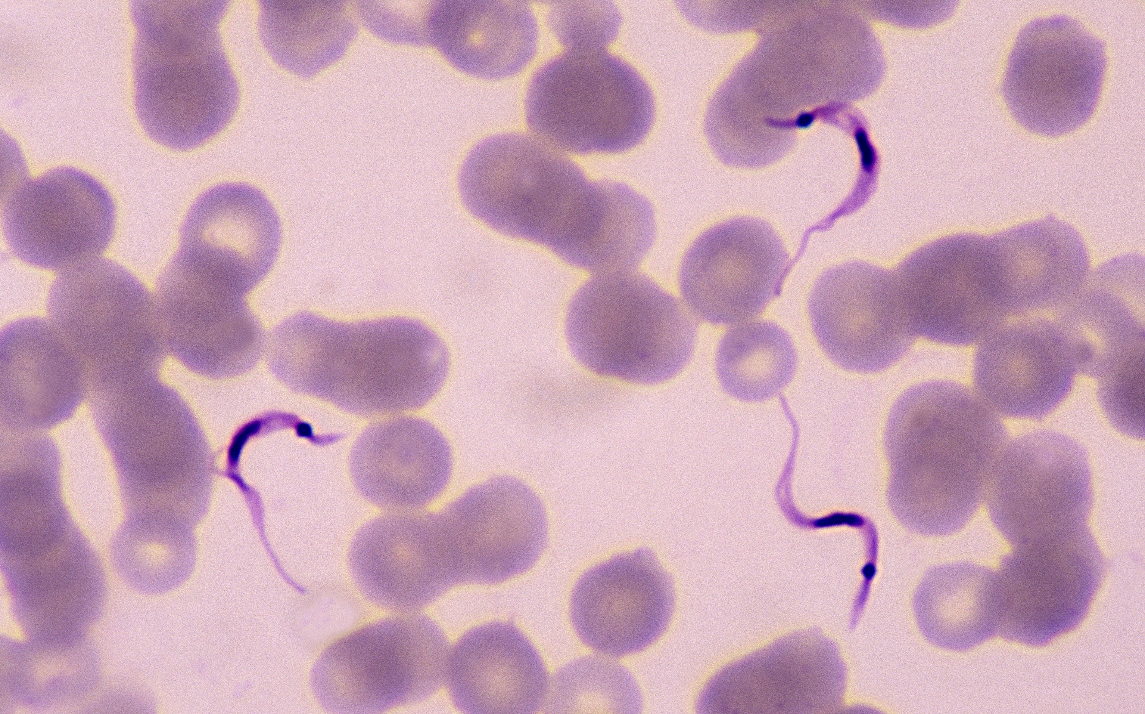 Trypanosoma cruzi, cause of Chagas Disease, Blood Smear, 400X at 35mm. Protozoan parasite with an undulating membrane, flagellum and nucleus. Common in South America. Transmitted by Triatomid bugs which suck blood.