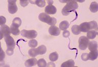 Ministério da Saúde chama atenção para transmissão oral da doença de Chagas