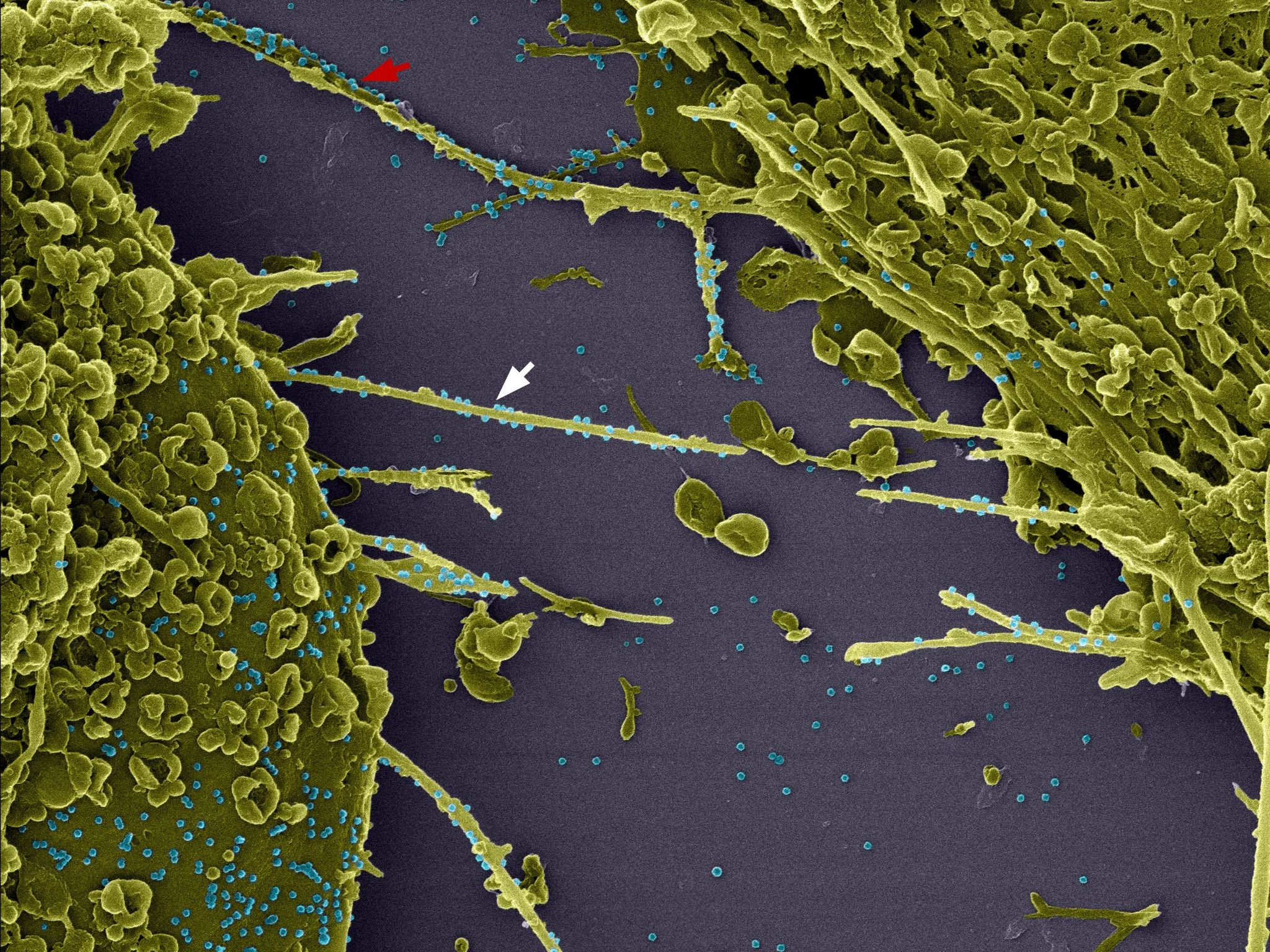 04_filopodio_viruses_grande
