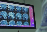 Remédio em estudo parece retardar progressão de Alzheimer, mas segurança preocupa