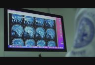 CNN Sinais Vitais aborda perspectivas sobre a doença de Alzheimer