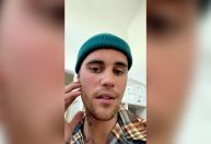 Entenda o que é a síndrome que causou paralisia no rosto de Justin Bieber