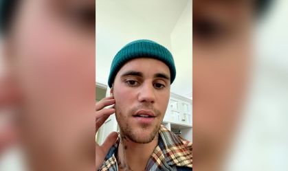 Entenda o que é a síndrome que causou paralisia no rosto de Justin Bieber