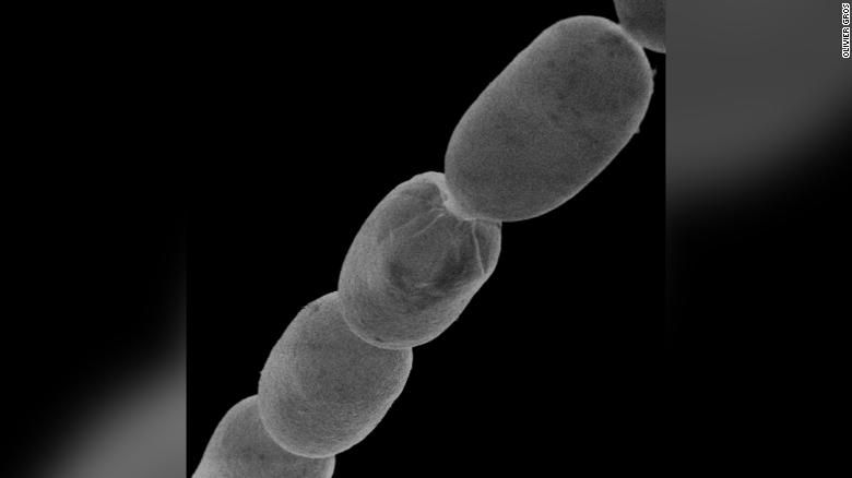 220623110656-04-giant-bacterium-thiomargarita-magnifica-exlarge-169