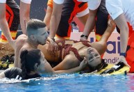 “As fotos até são bonitas”, conta nadadora resgatada após desmaiar na piscina