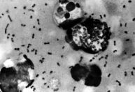 Análise de DNA revela possível local de origem da Peste Negra