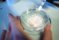 Mudando nosso DNA: ‘A era da edição de genes terapêuticos humanos chegou’