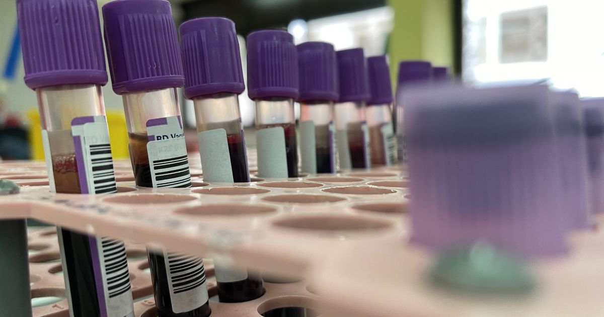 Estudo indica que jejum universal para exames de sangue é desnecessário
