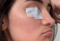 Paralisia de Bell: entenda os sintomas, diagnóstico e tratamento do problema