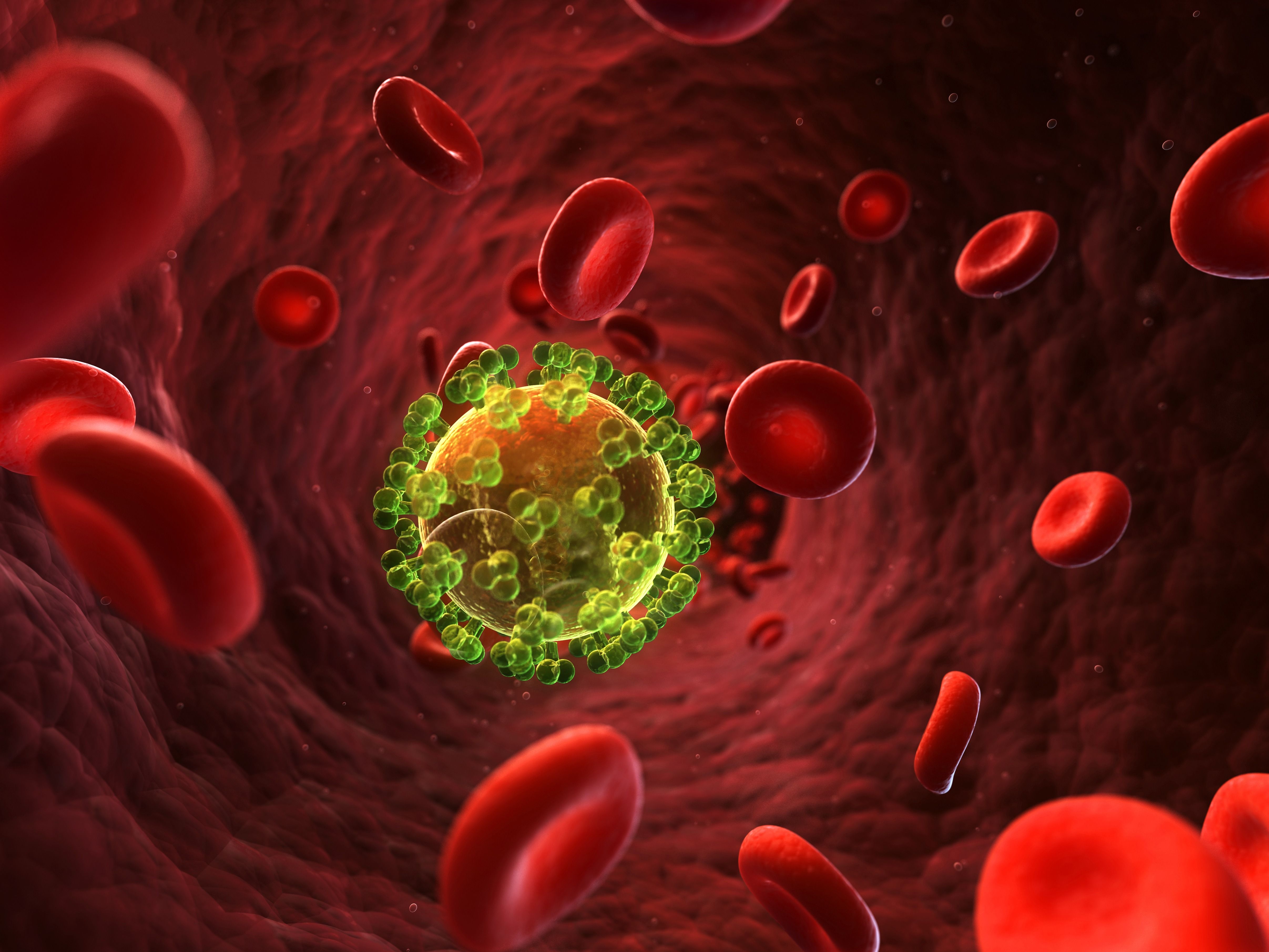 HIV infection, artwork