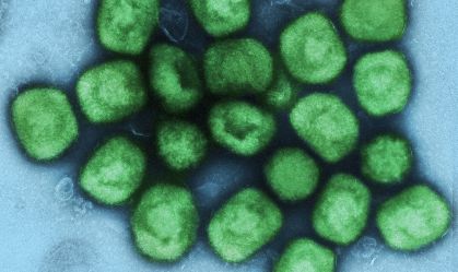 "Casos têm transcorrido de forma benigna", diz médica sobre varíola dos macacos