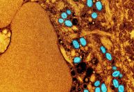 Especialistas contam o que é mito e o que é verdade sobre a varíola dos macacos