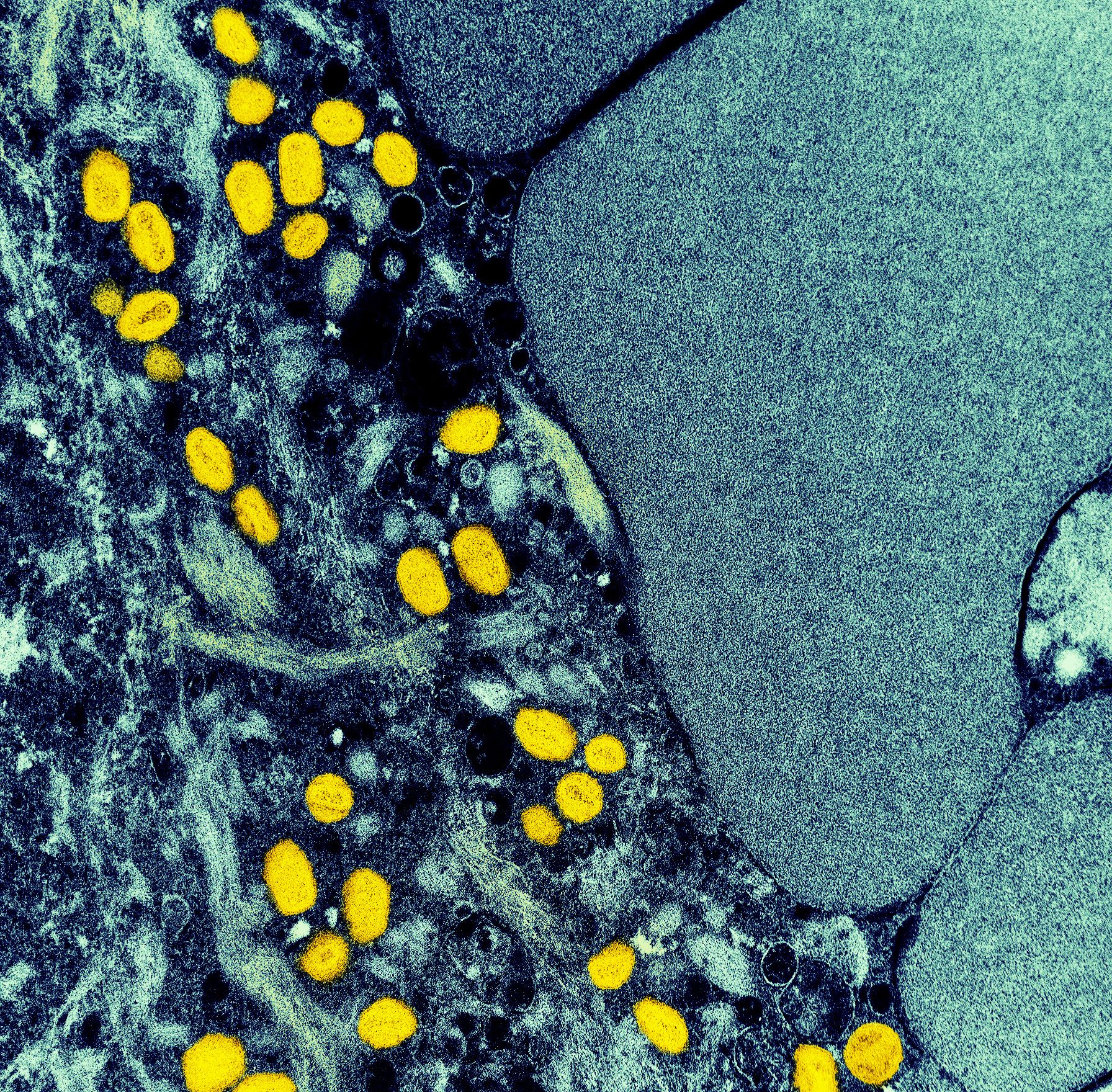 Imagem de microscopia do vírus Monkeypox, que causa a varíola dos macacos