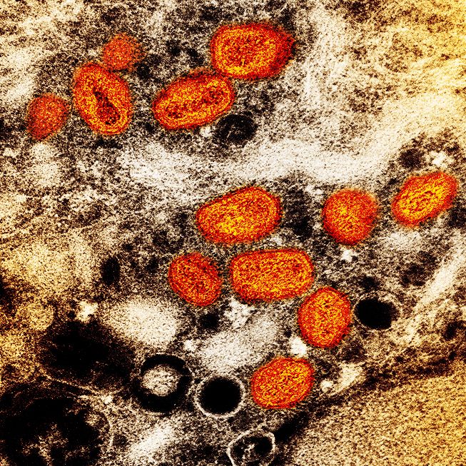 Imagem de microscopia do vírus Monkeypox, que causa a varíola dos macacos