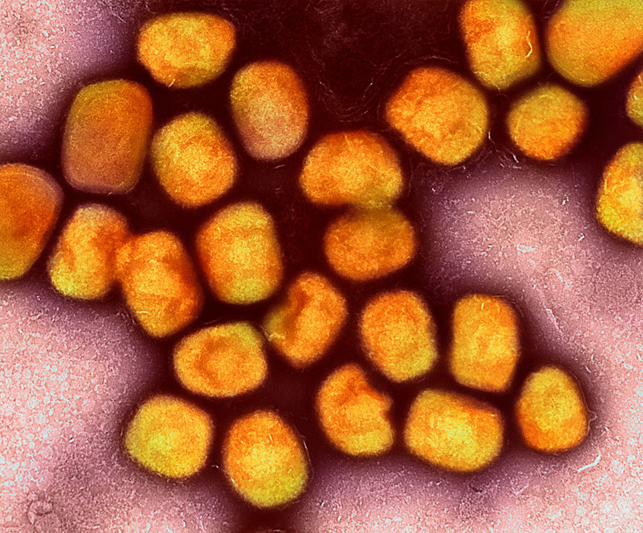 Imagem de microscopia do vírus Monkeypox, que causa a varíola dos macacos