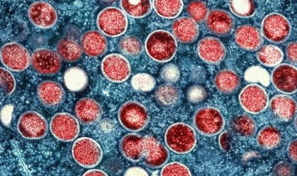 Varíola dos macacos: entenda como funciona o medicamento tecovirimat