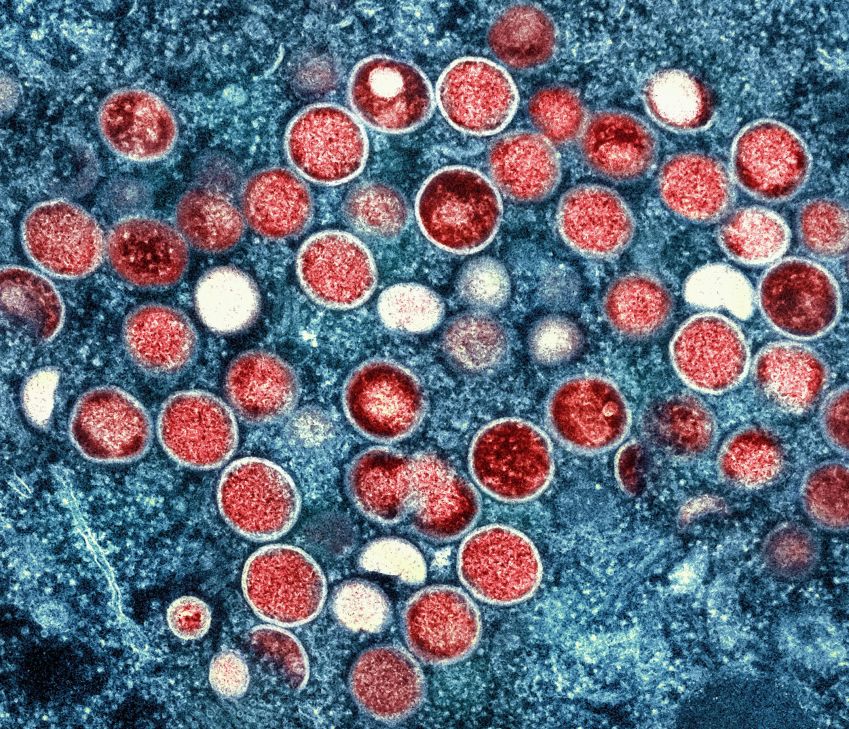 Imagem de microscopia do vírus Monkeypox, que causa a varíola dos macacos / National Institute of Allergy and Infectious Diseases (NIAID)